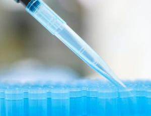 A blue pipette tip in a blue box - an example of the type of material recycled in the partnership between Veolia and GreenLabs 